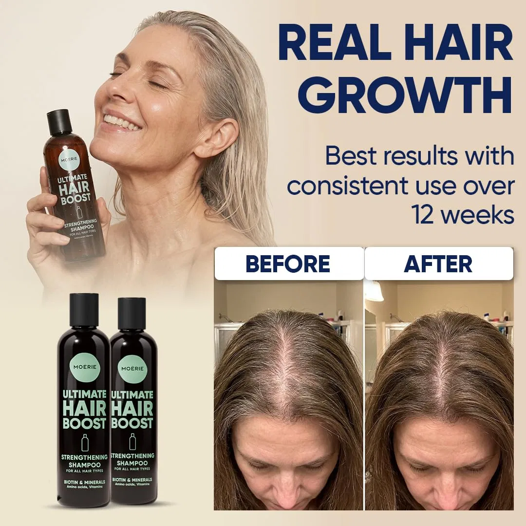Шампунь для роста волос с биотином и кофеином Moerie, Single Set Shampoo — фото 3