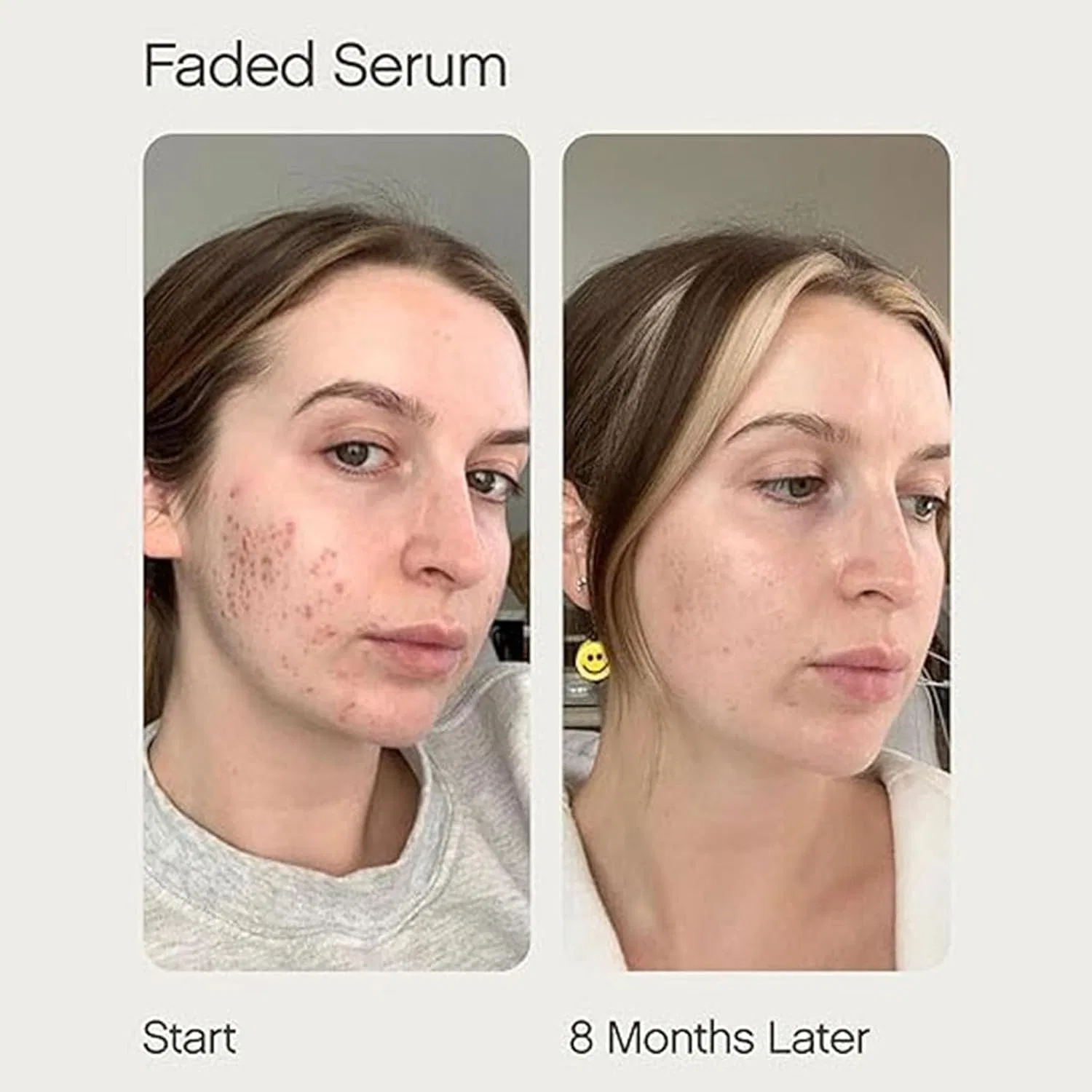Набор Faded: осветляющая сыворотка и увлажняющий крем Butter Aoseiens, 50 Ml - 2 Pieces — фото 4
