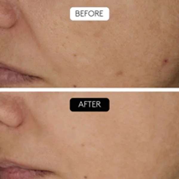 Средство для снятия макияжа Cocunat — Для лица Serum Clinical Beauty Filler — фото 4