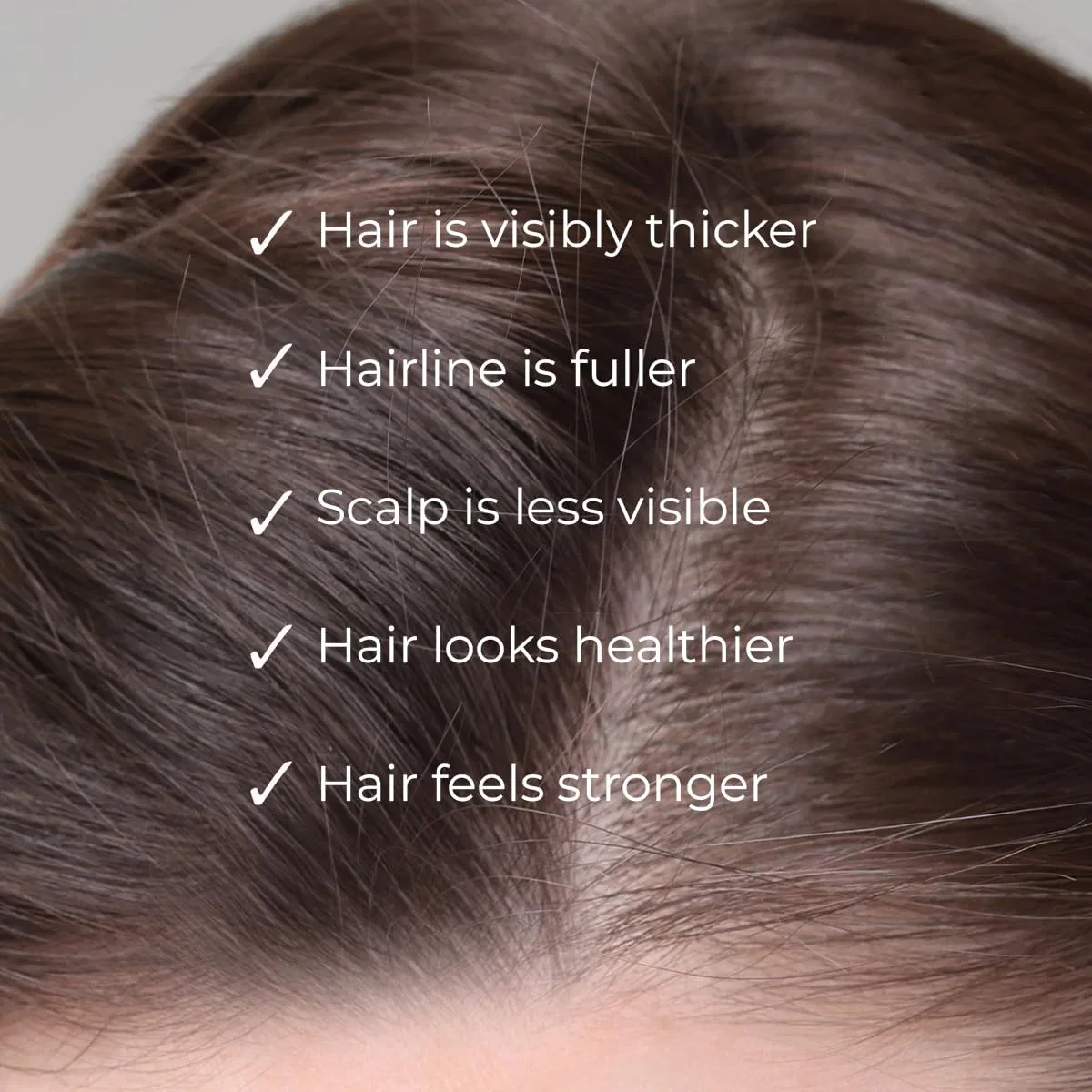 Сыворотка для роста волос Nanogen Hair Growth Factor Treatment Serum 30 мл Nanogen — фото 4