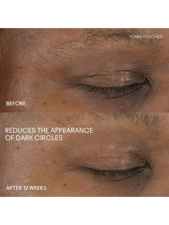 Сыворотка MAC — Для глаз Hyper Real Serumizer Eye ° Bright Eye Treatment, 15 мл — фото 2